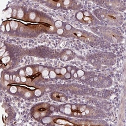 OGFOD3 Antibody, Novus Biologicals 0.1mL; Unlabeled:Antibodies, Polyclonal